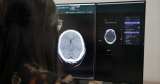 Australian healthtech company Annalise.ai releases next-generation CT Brain AI solution for clinical use
